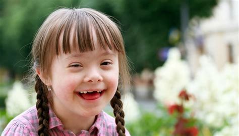 Down's syndrome is a condition in which chromosome 21 is duplicated, resulting in three copies rather than just two. Down Syndrome - PTC Kids