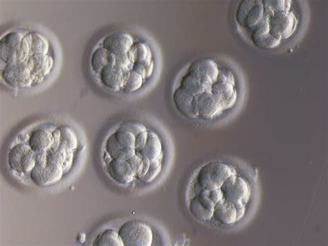 New IVF Discovery: Embryo Abnormalities Can be Caught 