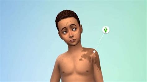 Sims 4 Is Adding Stretch Marks Birthmarks And C Section Scars In Next