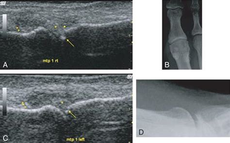Comparison Of Ultrasound Images And Conventional Radiography Images A