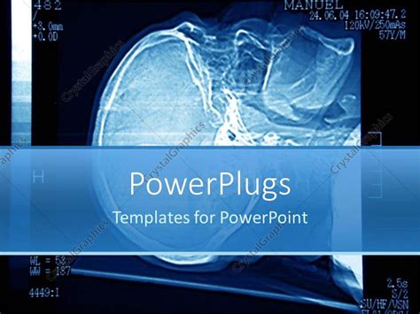 Powerpoint Templates X Ray