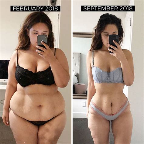Woman Reveals Before And After Pictures Of Her 141 Pound Weight Loss