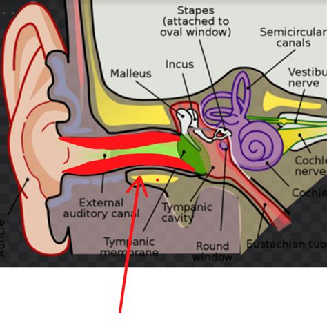 Ear Infections Medical Care One