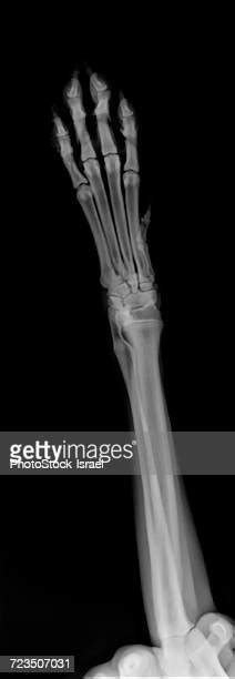 Dog Xray Leg Photos And Premium High Res Pictures Getty Images