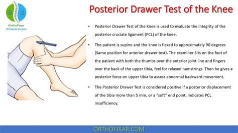 Posterior Drawer Test Of The Knee Easy Explained Orthofixar 2022 In