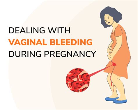 dealing with vaginal bleeding during pregnancy what expecting mums should know