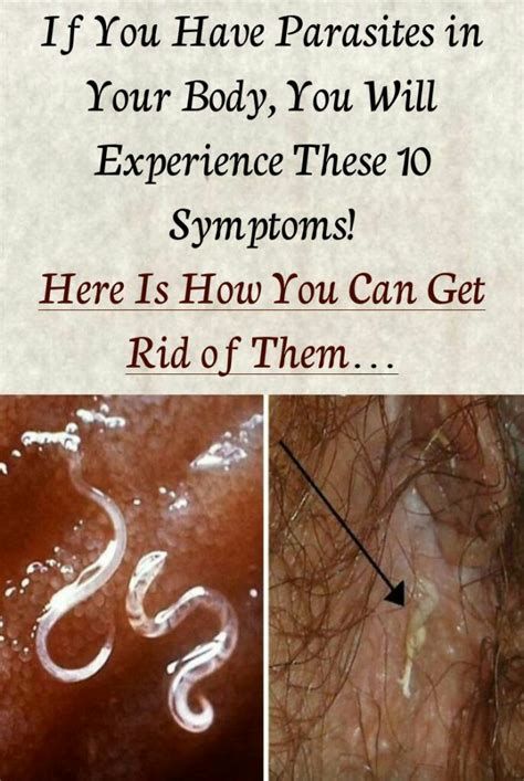 In Case You Missed If You Have Parasites In Your Body You Will