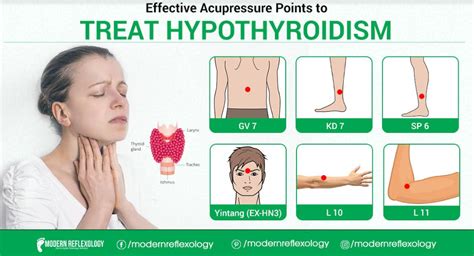 Effective Acupressure Points To Treat Hypothyroidism Modern Reflexology