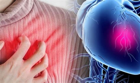 Heart Attack Symptoms Signs Such As Chest Pain Can Appear Months In