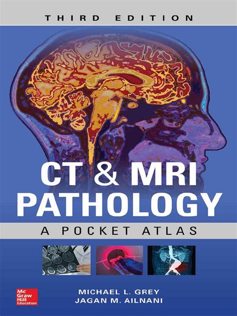 Ct And Mri Pathology A Pocket Atlas Brain Tumor Magnetic Resonance