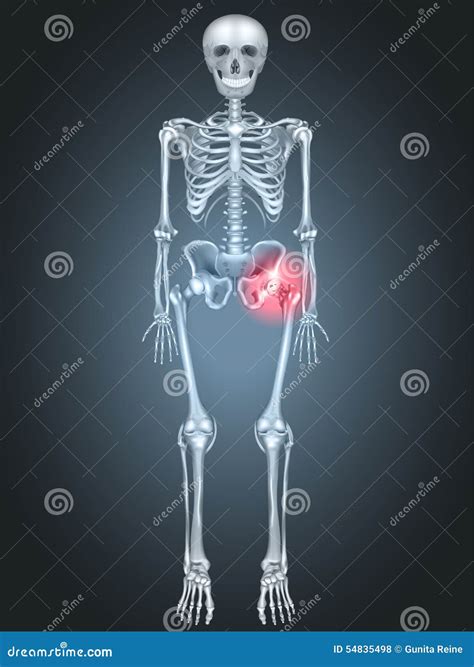 Skeleton With Hip Pain Stock Vector Illustration Of Joint 54835498