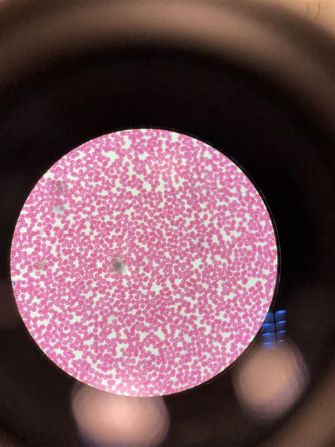 Normal Blood Cells Under Microscope