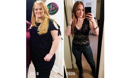 Bariatric Success Story Meghan Burns Regains Comfort And Confidence
