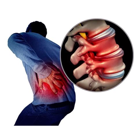 Dealing Safely With Mechanical Low Back Pain Askawayhealth