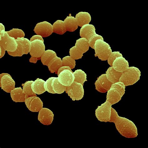 Streptococcus Pneumoniae Adalah Penyakit Homecare24