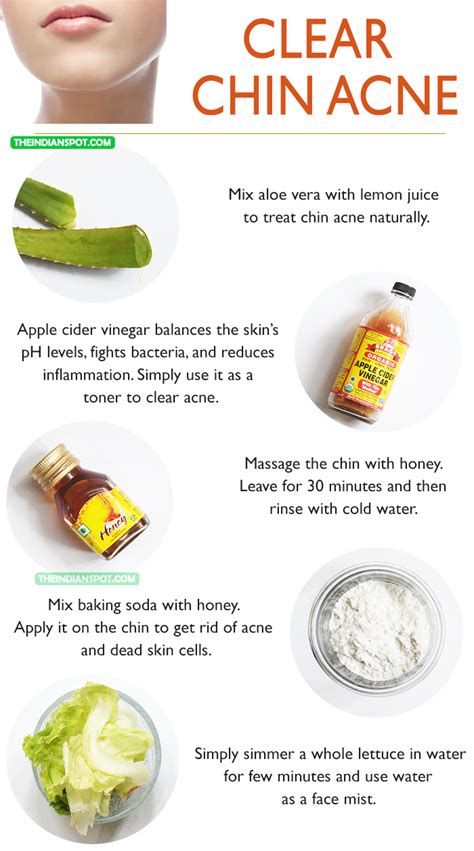 Get rid from pimples on forehead. WHY YOU GET CHIN ACNE -AND HOW TO CLEAR IT UP