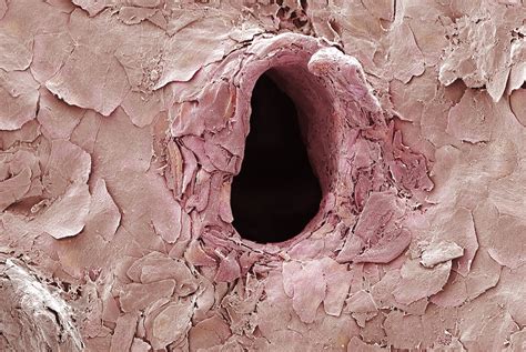 Holes In Skin Deep