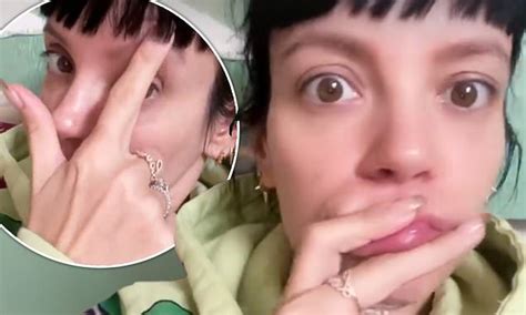 Lily Allen Complains About Her Eyebrows After Telling Fans Shes