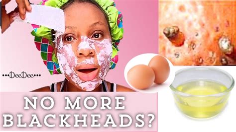 easy diy egg white blackhead remover peel off mask deedee tries it youtube