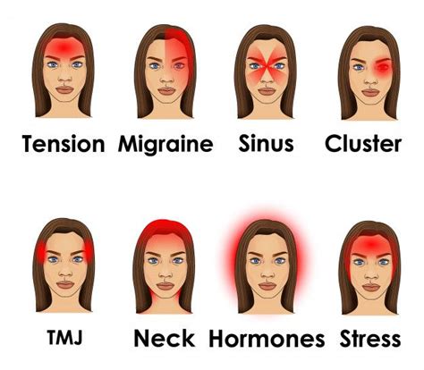 Types Of Headache Illustrated On A Woman Face In 2020 Headache Types