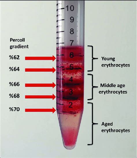 Whole Blood Samples Were Fractionated With Percoll Density Gradient