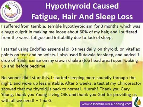 Hair loss and weight gain are both signs of adrenal fatigue. Endoflex for thyroid help. Hypothyroidism caused fatigue ...
