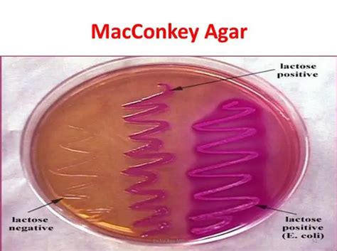 Salmonella Typhi Macconkey Agar Macconkey Agar Plate With Salmonella