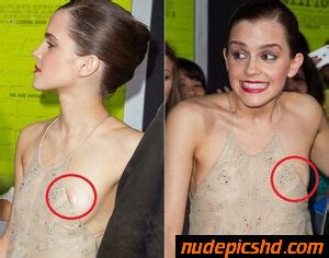 Emma Watson Celebrity Wardrobe Malfunctions Nude Leaked Porn Photo Nudepicshd