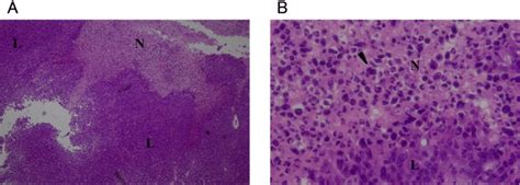 Histological Images Of Tumors After Administration Of Mm Ozonated