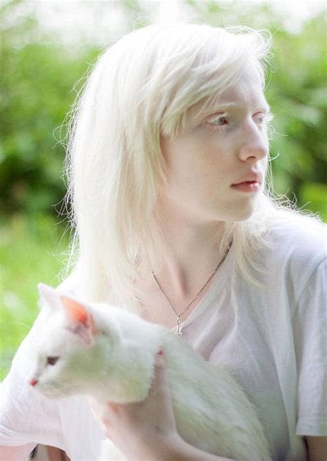 Gadis Albino Ini Dahulunya Sering Dihina Kini Menjadi Model