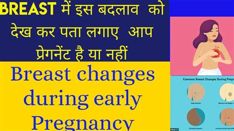 Early Pregnancy Symptoms Breast Changes During Pregnancy Youtube
