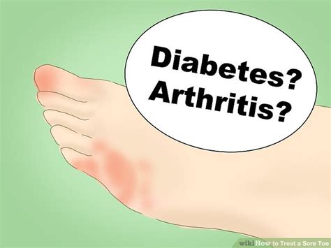 How To Treat A Sore Toe 13 Steps With Pictures Wikihow