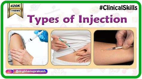 Types Of Injection Sites Techniques Intra Muscular Intra Dermal Subcutaneous YouTube