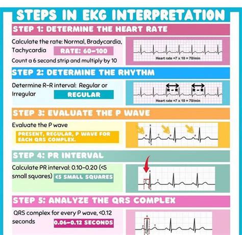 Ekg Interpretation Medizzy