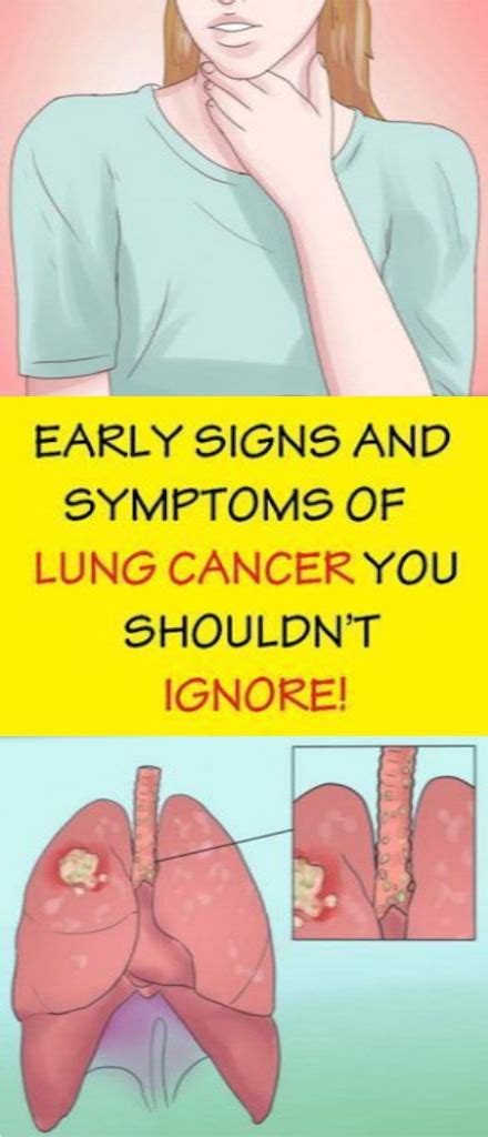Early Warning Symptoms Of Lung Cancer You Shouldnt Ignore Healthy