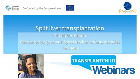 Split Liver Transplantation Transplantchild Webinars Youtube
