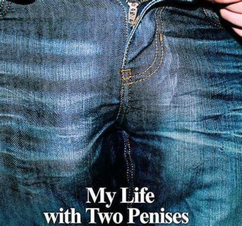 Así es la vida del hombre que nació con dos penes de 25 centímetros