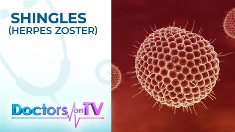 Symptoms Treatment And Prevention Of Shingles Herpes Zoster Doctors