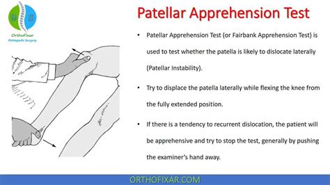 Patellar Apprehension Test Easy Explained Orthofixar 2022 Arthritis