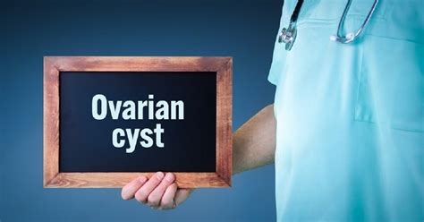 Ovarian Cyst Symptoms Treatment And Causes Little Angel Ivf