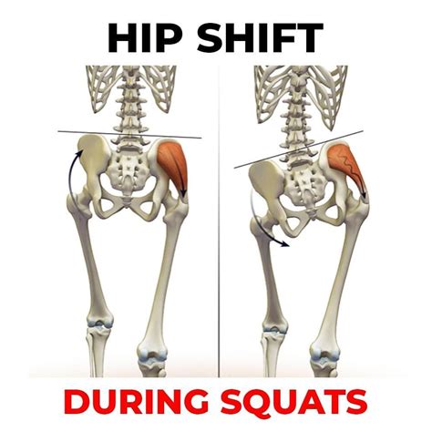 James Lu Rmt 🇨🇦 To On Instagram “🚨 How To Correct Hip Shift During