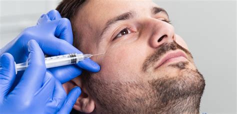Botox For Men Everything You Need To Know