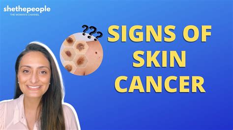 What Are The Signs Of Skin Cancer Answers Dr Aanchal Panth Youtube
