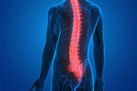 Lesiones En La Medula Espinal