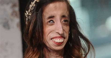 Woman Branded Worlds Ugliest Reveals How She Fought Back Against