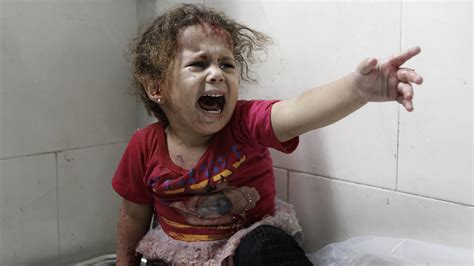 أطفال غزة المصابين في الحرب ما زالوا يعالجون وكالة سوا الإخبارية