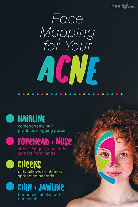 Acne Face Chart A Visual Reference Of Charts Chart Master