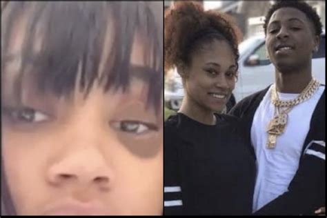 Nba Youngboys Girlfriend Jania Says She Got A Black Eye From Hot Water