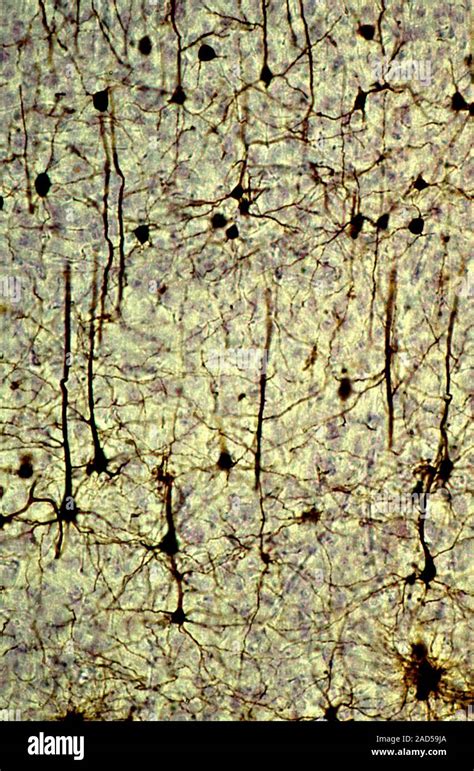 Luz Brightfield Micrografía De Neuronas Piramidales Células Nerviosas