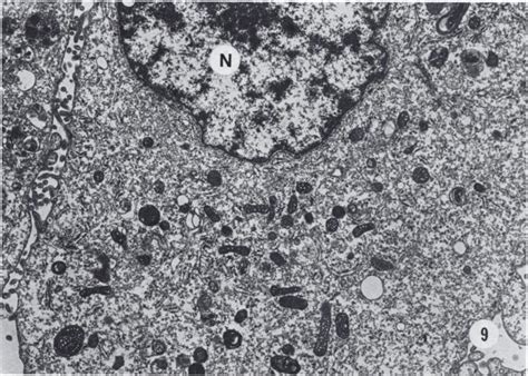Transmission Electron Micrograph Of A Liver Cell 7222 Cloned From A